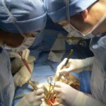 transplantation-hepatique-maroc